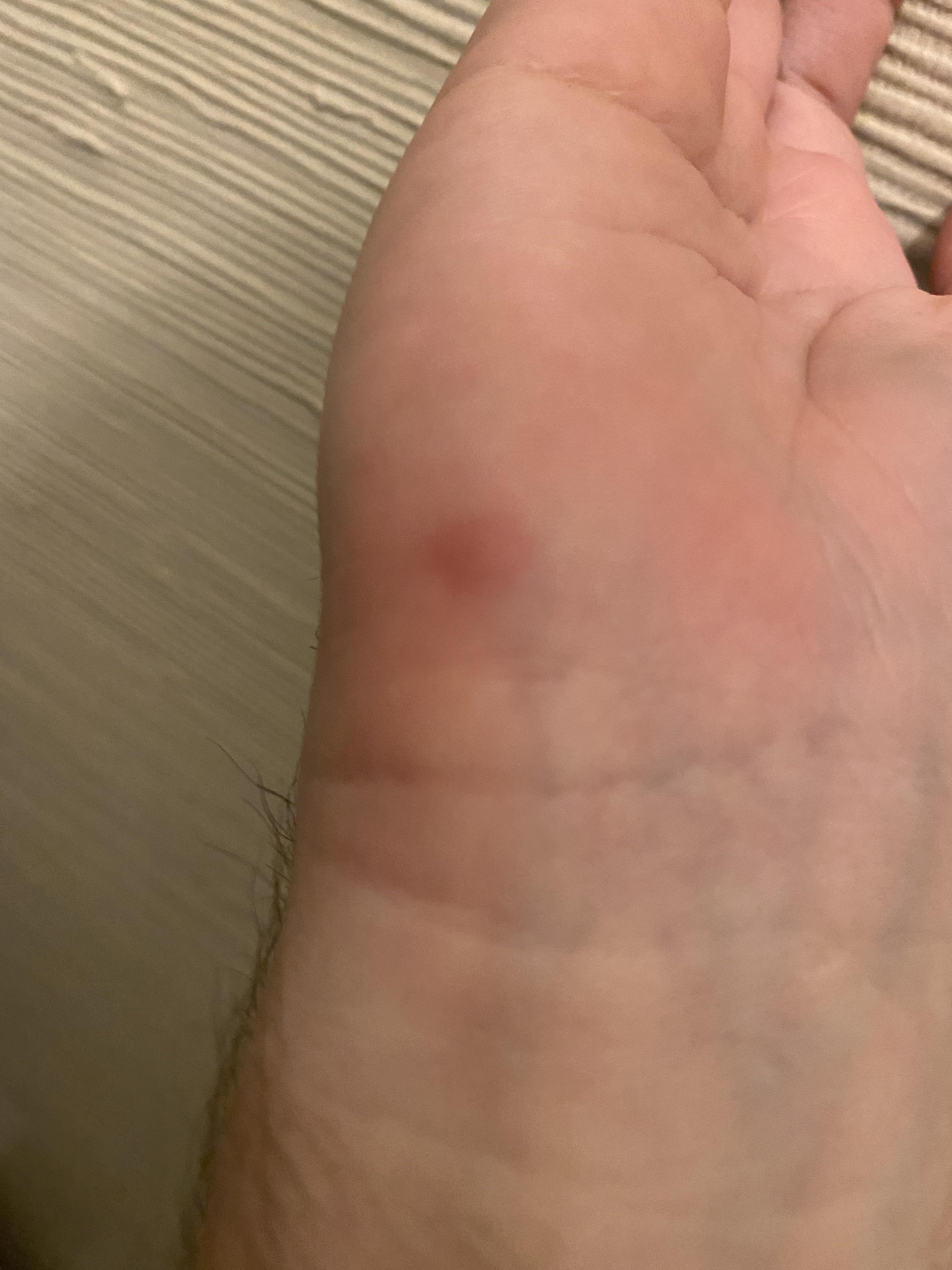 Why Does My Wrist Hurt When Using Mouse for Long Time